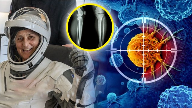 Sunita Williams Health After Return To Earth, Cancer, Depression and Bone Loss High Risk कैसे