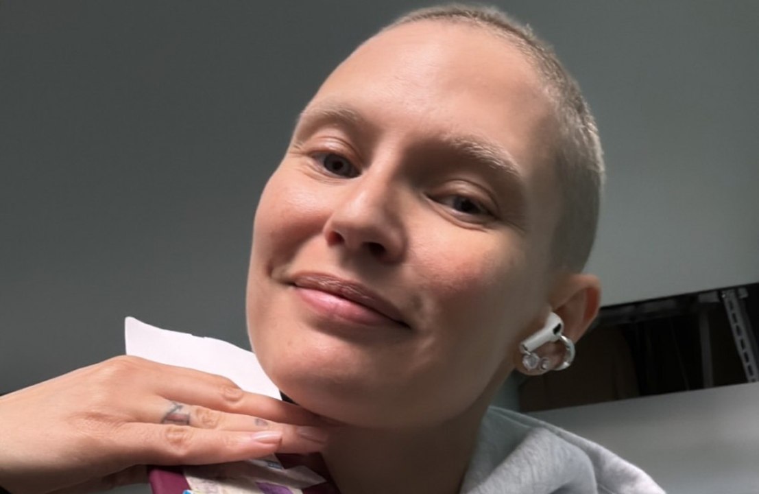 Bianca Balti, ricrescono capelli dopo la chemio