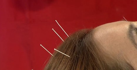 Terapia para dormir bien: los secretos milenarios de la medicina china