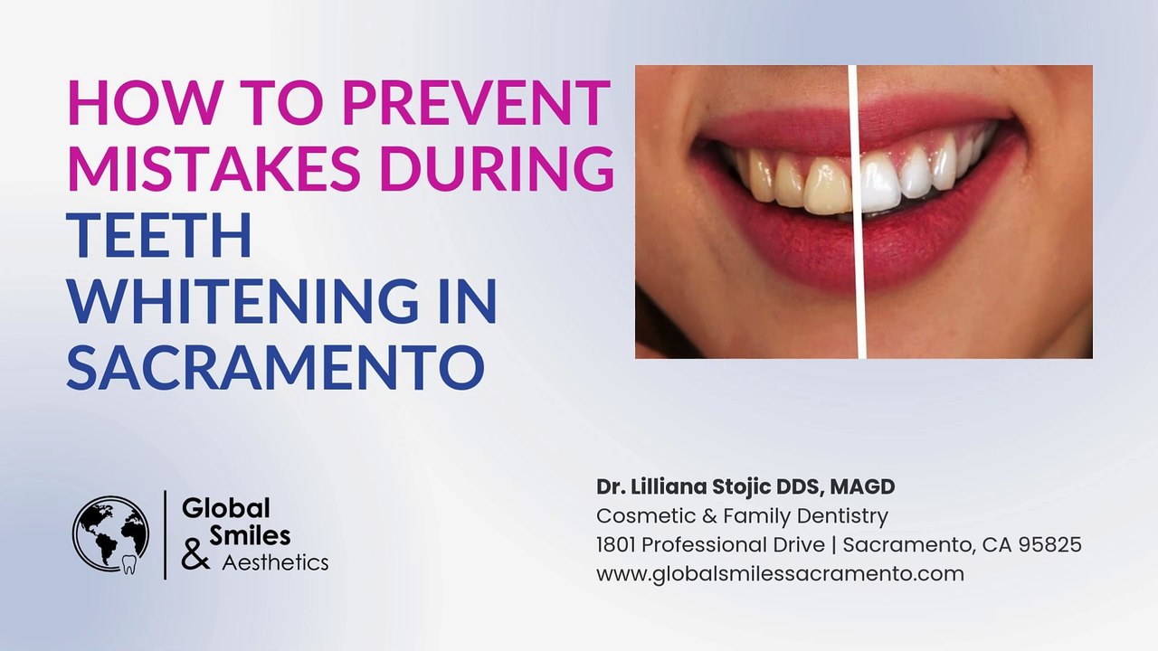 How to Prevent Mistakes During Teeth Whitening in Sacramento