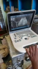 Goat Ultrasound for Pregnancy Check 🐐