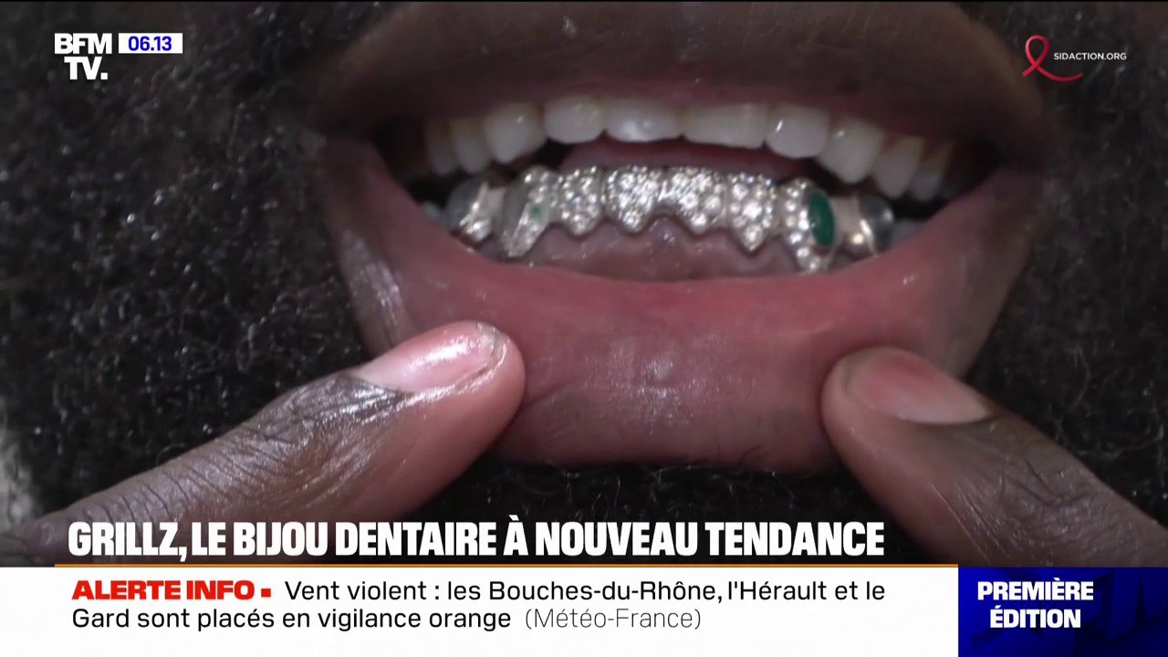 Grillz: comment ces bijoux dentaires sont redevenus tendance chez les jeunes