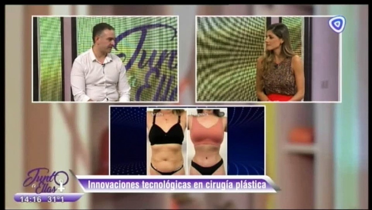 Programa Junto a Ellas 20-03-25