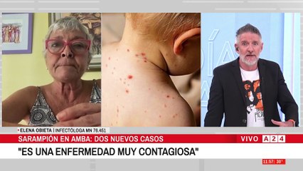 🔴 ALERTA POR CASOS DE SARAMPIÓN🔴"ALTAMENTE CONTAGIOSA POR VÍA RESPIRATORIAS"
