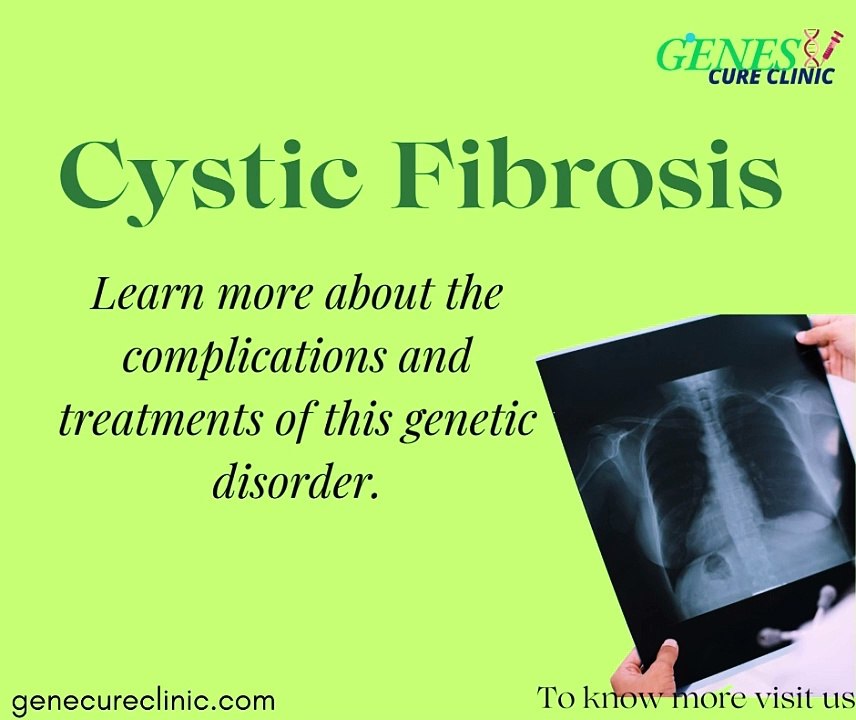 cystic fibrosis