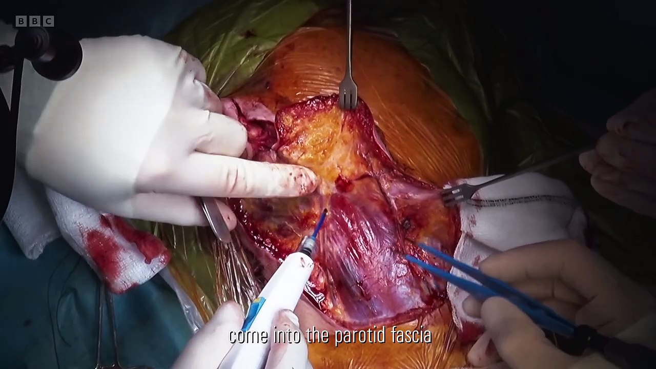 Surgeons: At the Edge of Life episode 10