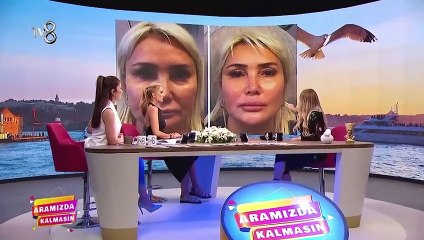 Yonca Evcimik Gel Konuşalım'da Estelift Uygulamasını Anlatıyor!