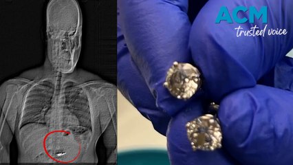 Breakfast at Tiffany’s: Suspect allegedly swallows stolen diamonds
