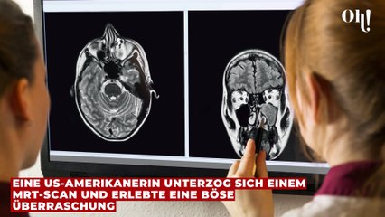 MRT-Scan aus Neugier: US-Amerikanerin erlebt böse Überraschung nach Untersuchung
