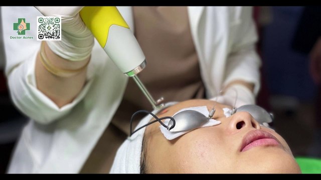 Laser Pico trị sẹo tại Phòng khám Da liễu Doctor Acnes