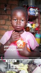 Rougeole : en RDC, 20 enfants meurent chaque jour