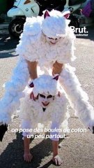 Gravement brûlée, Julie Bourges raconte son accident et sa reconstruction