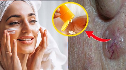 Sunscreen Side Effect On Skin:सनस्क्रीन लगाते वक्त 1 गलती,Skin Rashes से लेकर Cancer का खतरा