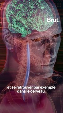 4 questions sur les particules fines