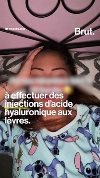 Injections dans les lèvres, quels sont les risques ?