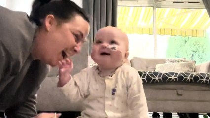 Baby overcomes cleft lip and says "mama" for the first time