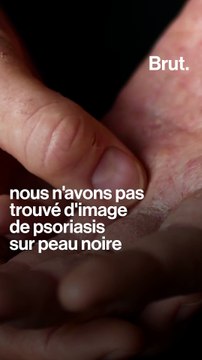 3 exemples de pratiques racistes en médecine