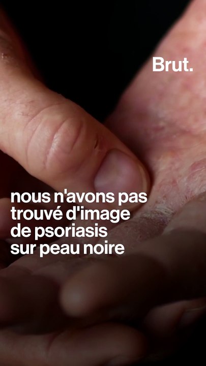 3 exemples de pratiques racistes en médecine