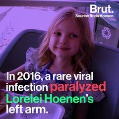 Dad-Daughter duo builds her a prosthetic arm