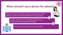 When should I see a doctor for edema? #swelling #edema