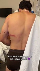 El influencer Gero Arias perdió dos dedos tras caer de un acantilado