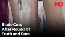 Gujarat school kids cut themselves with blades for a dare