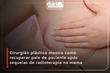 Cirurgião plástico mostra como recuperar pele de paciente após sequelas de radioterapia na mama