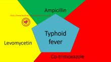 Treatment of typhoid fever #typhoidfever #typhoidtreatment