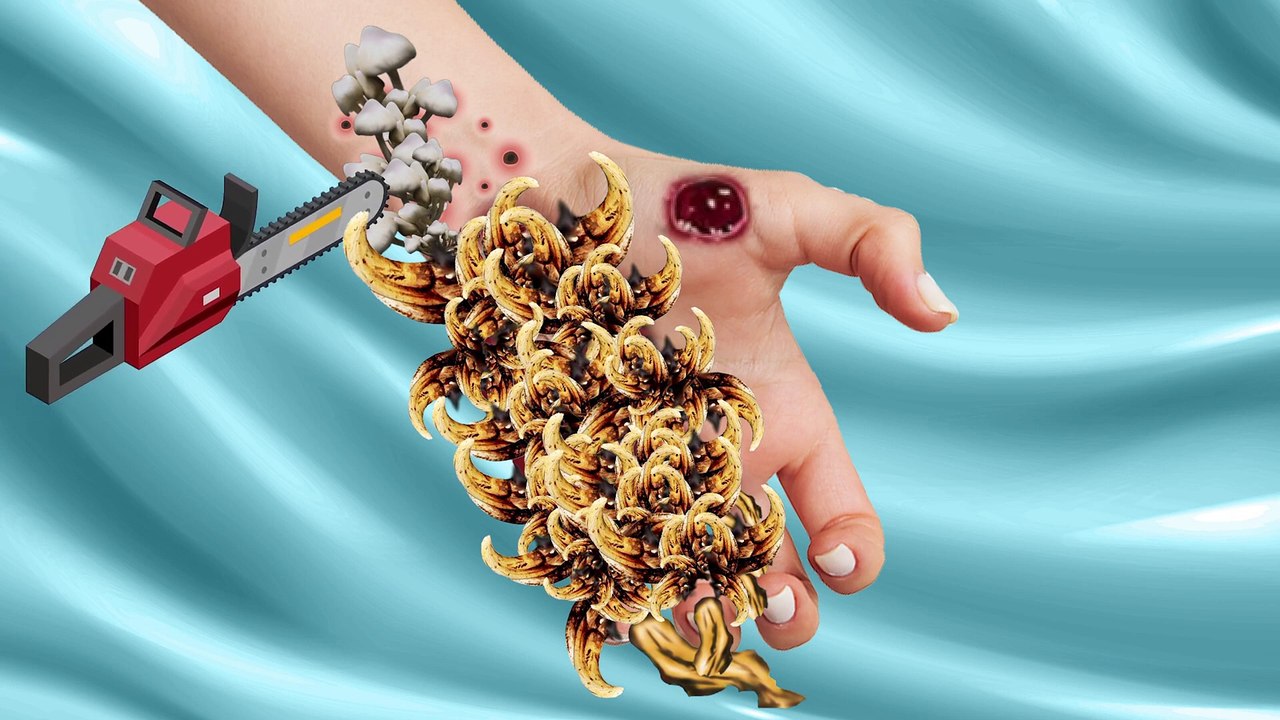 23. ASMR Remove Maggot & Dog Ticks Infected Hand   Deep Cleaning ASMR Animation