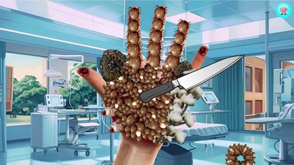 26. ASMR Removal Maggot & Dog Ticks Infected Hand   Deep Cleaning ASMR Animation