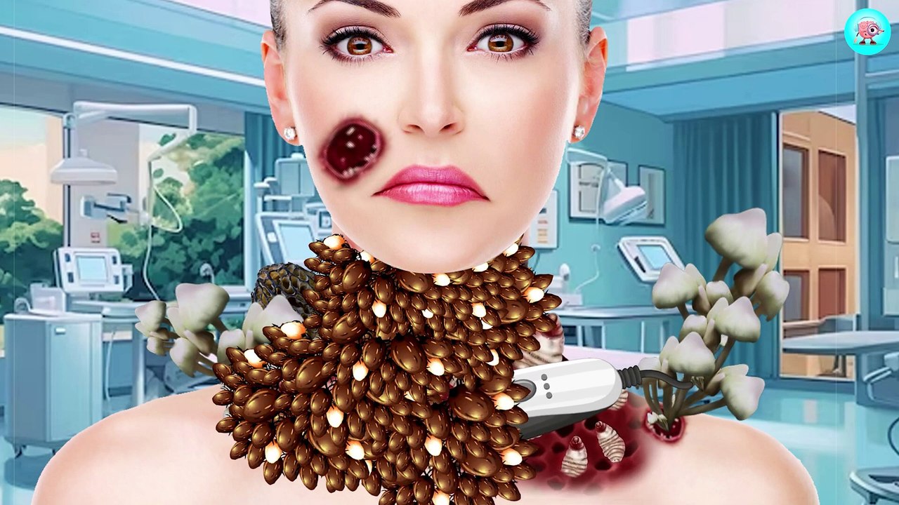 29. ASMR Remove Maggot & Dog Ticks Infected Neck   Deep Cleaning ASMR Animation