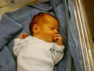 APRES MON TT 1ER BAIN (à 3 J)