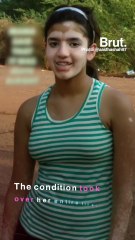 Patchy Skin Is Still A Win