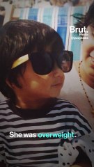 This Woman's Eating Disorder Almost Killed Her