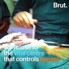 Man recites Hanuman Chalisa during brain surgery