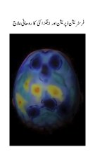 Depression ka ilaaj-Baba Irfan-Final