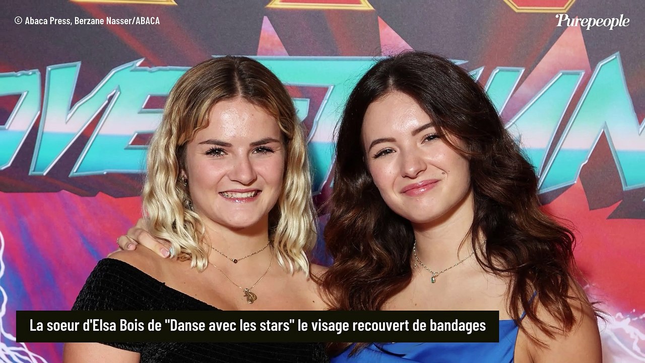 Elsa Bois (Danse avec les stars) : Sa petite soeur Alizée photographiée le visage entouré de bandages et à l'hôpital