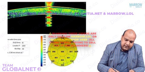 30. Cornea - Special Investigation