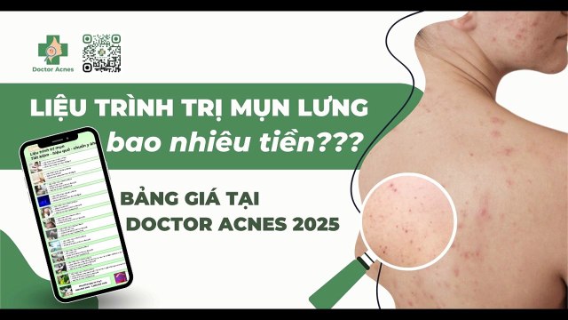 Liệu trình trị mụn lưng bao nhiêu tiền? Giá tại Doctor Acnes