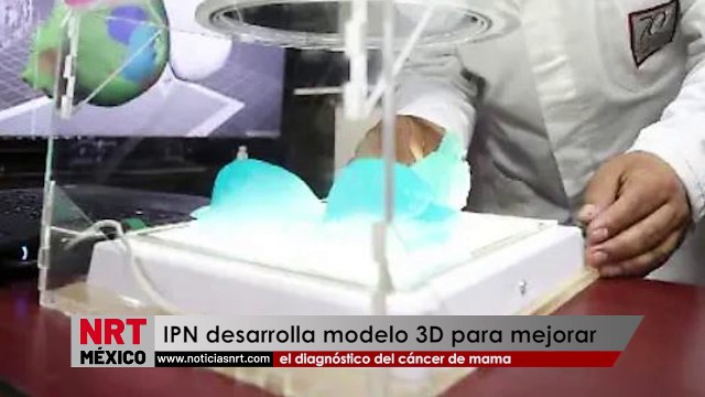 IPN desarrolla modelo 3D para mejorar el diagnóstico del cáncer de mama