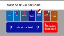 The signs of spinal stenosis