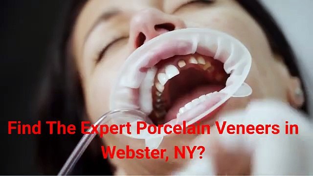Empire Dental Care - Expert Porcelain Veneers in Webster, NY