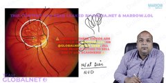 27. Retina - Vascular disorders - Part 1