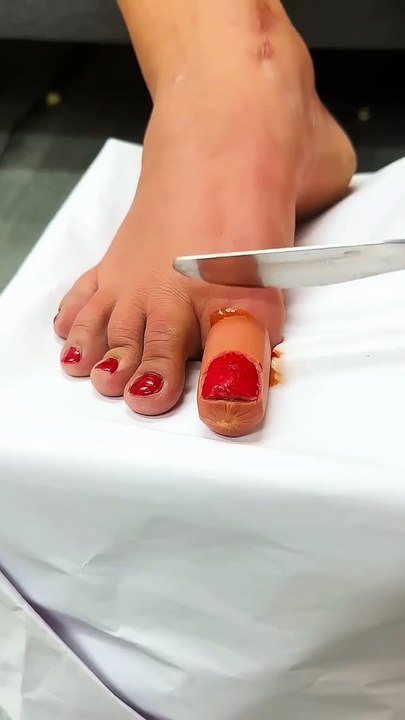 Torung-Comedy-Magic-Toes🤣(720p)