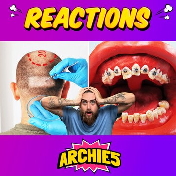 Dudes vs. The Operating Room! 🙀 Surgeries and C-Sections Revealed!