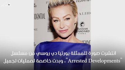 بورتيا دي روسي تخضع لعمليات تجميل