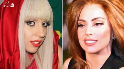 صور صادمة لأشهر النجمات قبل وبعد عمليات التجميل