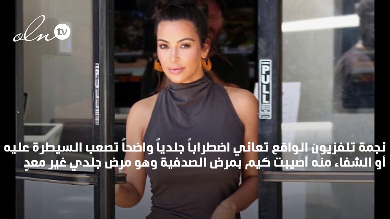 كيم كارداشيان ترفض تغطية بقع الصدفية في جسمها!