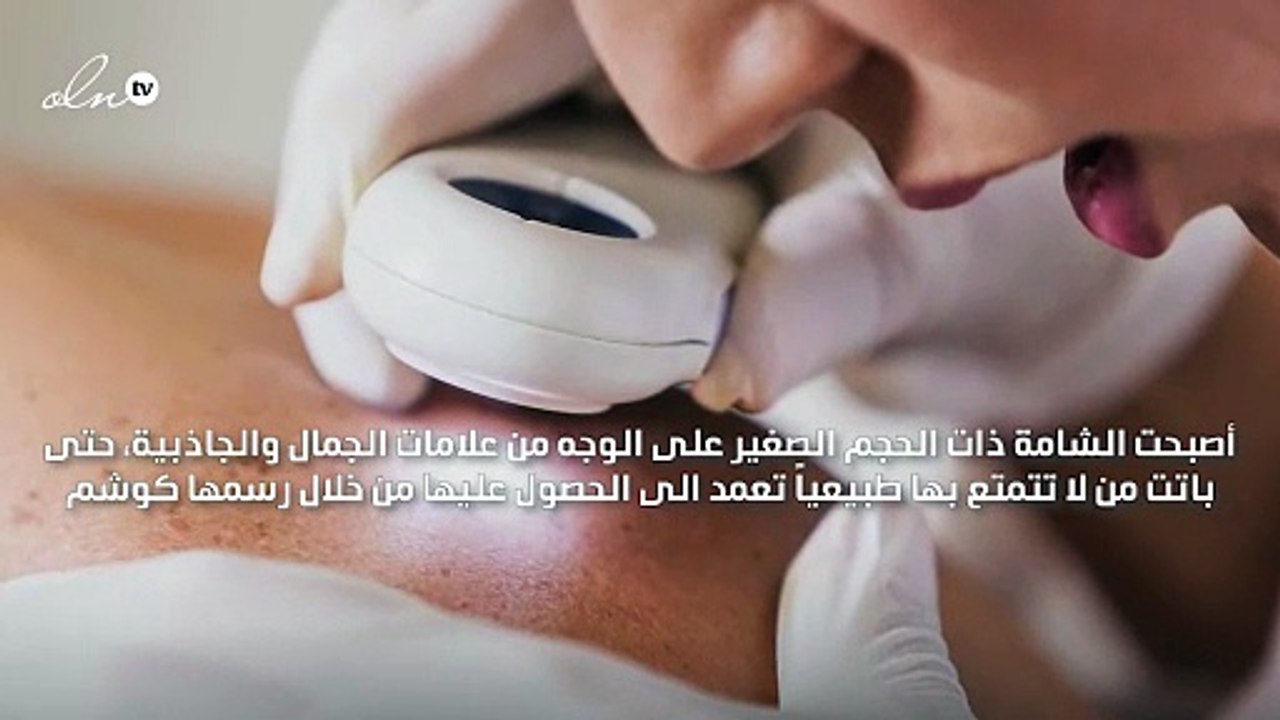 للشامة معانٍ أبعد من أنها من علامات الجمال... تعرّفي إليها!