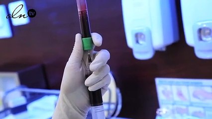 احصلي على نضارة بشرة كيم كارداشيان مع حقن البلازما PRP